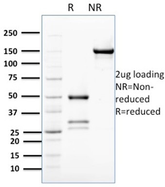 BCL2-like 2 (BCL2L2)/BCL-W Antibody in SDS-PAGE (SDS-PAGE)