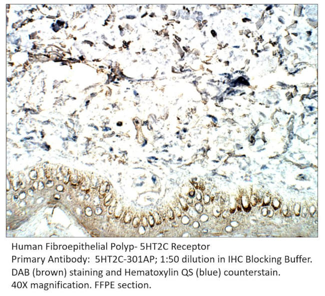 5HT2C Receptor Antibody in Immunohistochemistry (IHC)