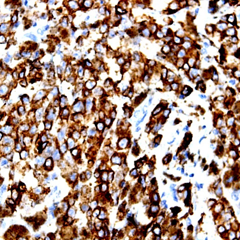 Phospho-BCAR3 (Thr130) Antibody in Immunohistochemistry (Paraffin) (IHC (P))