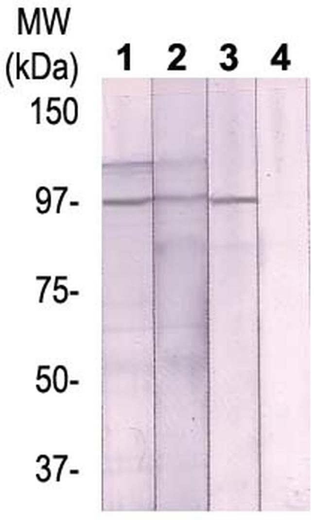 Phospho-BCAR3 (Thr130) Antibody in Western Blot (WB)