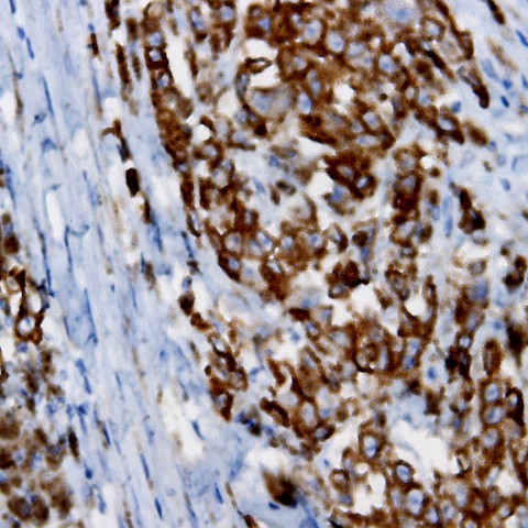 BCAR3 Antibody in Immunohistochemistry (Paraffin) (IHC (P))