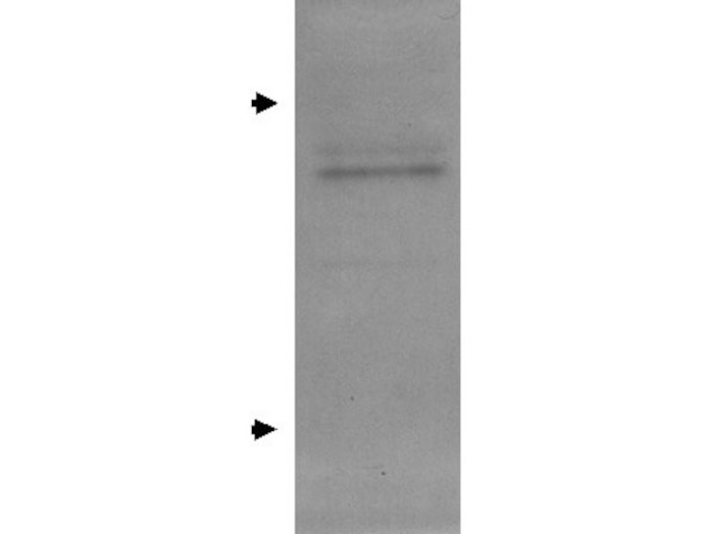 Apolipoprotein E Antibody in Western Blot (WB)