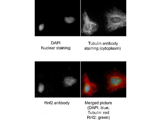 RING1B Antibody in Immunocytochemistry (ICC/IF)