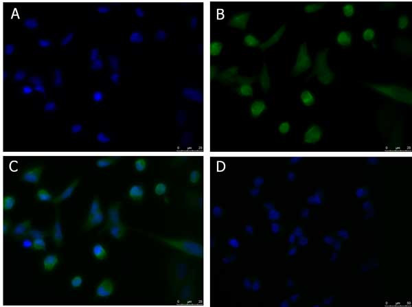 PDL1 Antibody in Immunocytochemistry (ICC/IF)