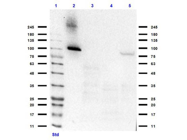 Aldh1l1 Antibody in Western Blot (WB)