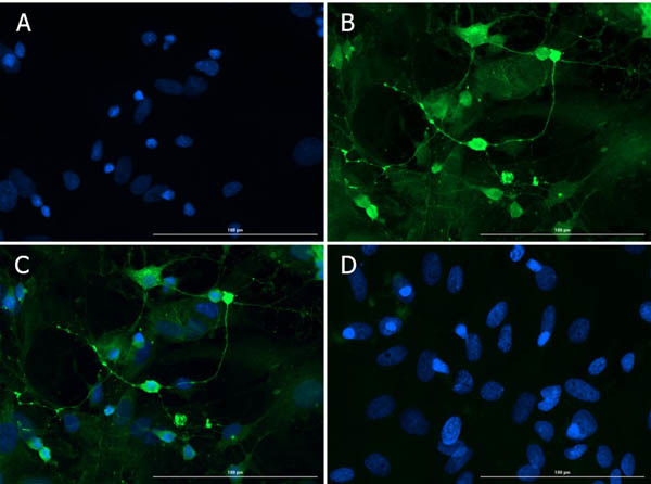 Doublecortin Antibody in Immunocytochemistry (ICC/IF)