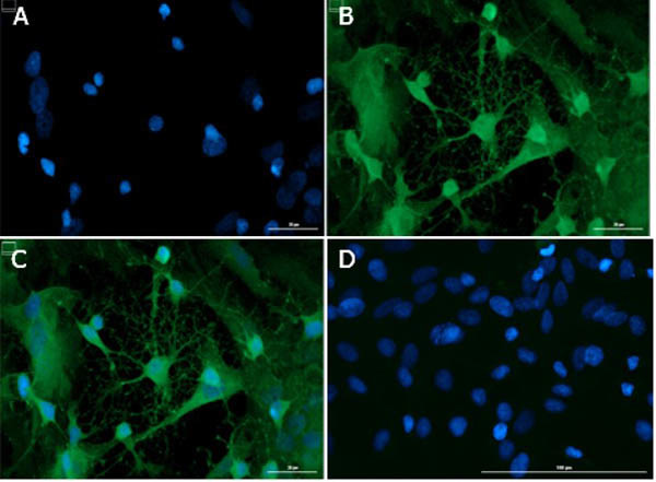 Doublecortin Antibody in Immunocytochemistry (ICC/IF)