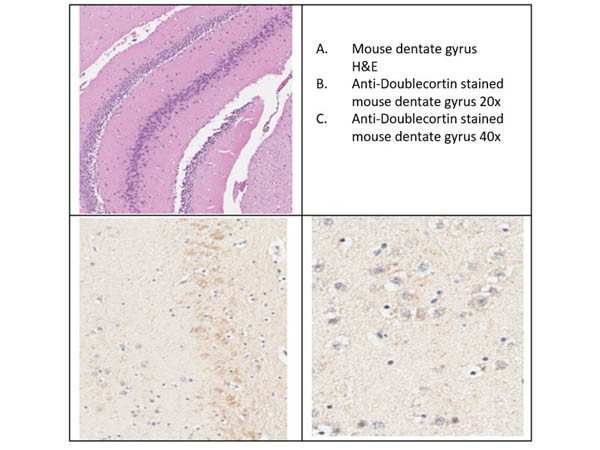 Doublecortin Antibody in Immunohistochemistry (IHC)