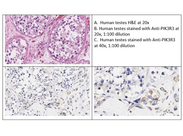 PI3 Kinase p55 gamma Antibody in Immunohistochemistry (IHC)