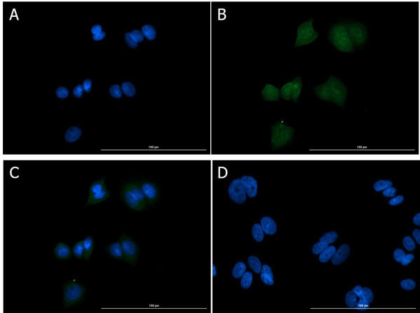 EEF1A2 Antibody in Immunocytochemistry (ICC/IF)