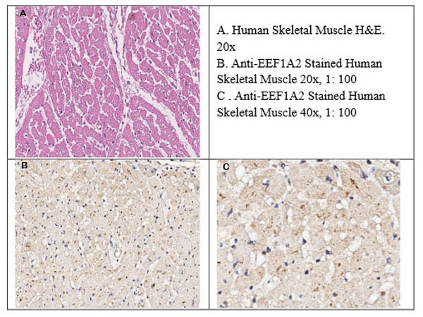 EEF1A2 Antibody in Immunohistochemistry (IHC)