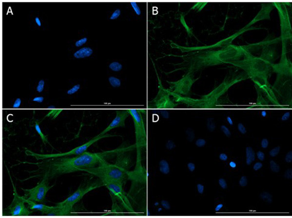 Eaat2 Antibody in Immunocytochemistry (ICC/IF)