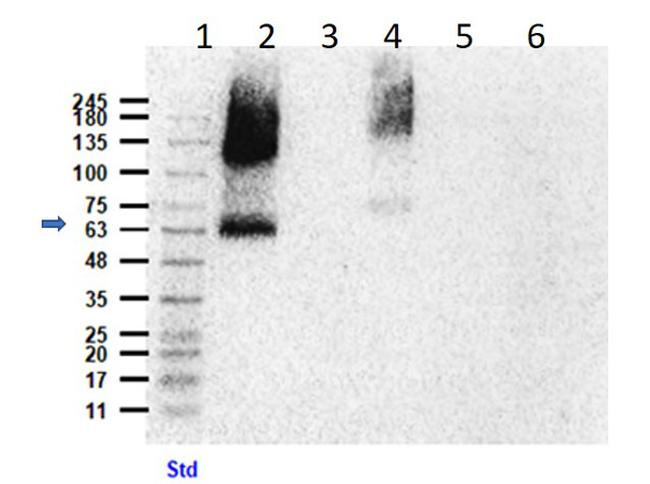 Eaat2 Antibody in Western Blot (WB)