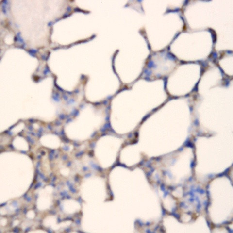 BTC Antibody in Immunohistochemistry (Paraffin) (IHC (P))