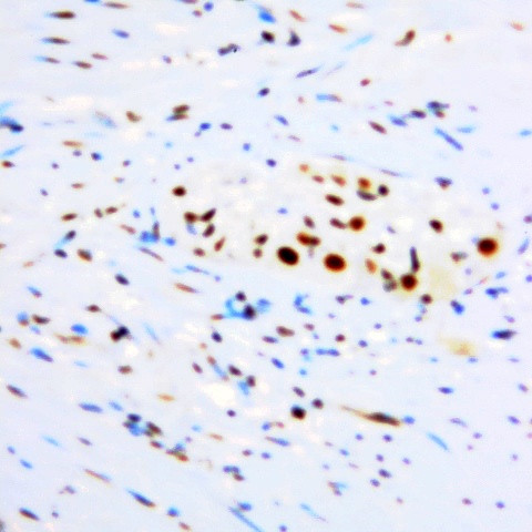 PPARd Antibody in Immunohistochemistry (Paraffin) (IHC (P))