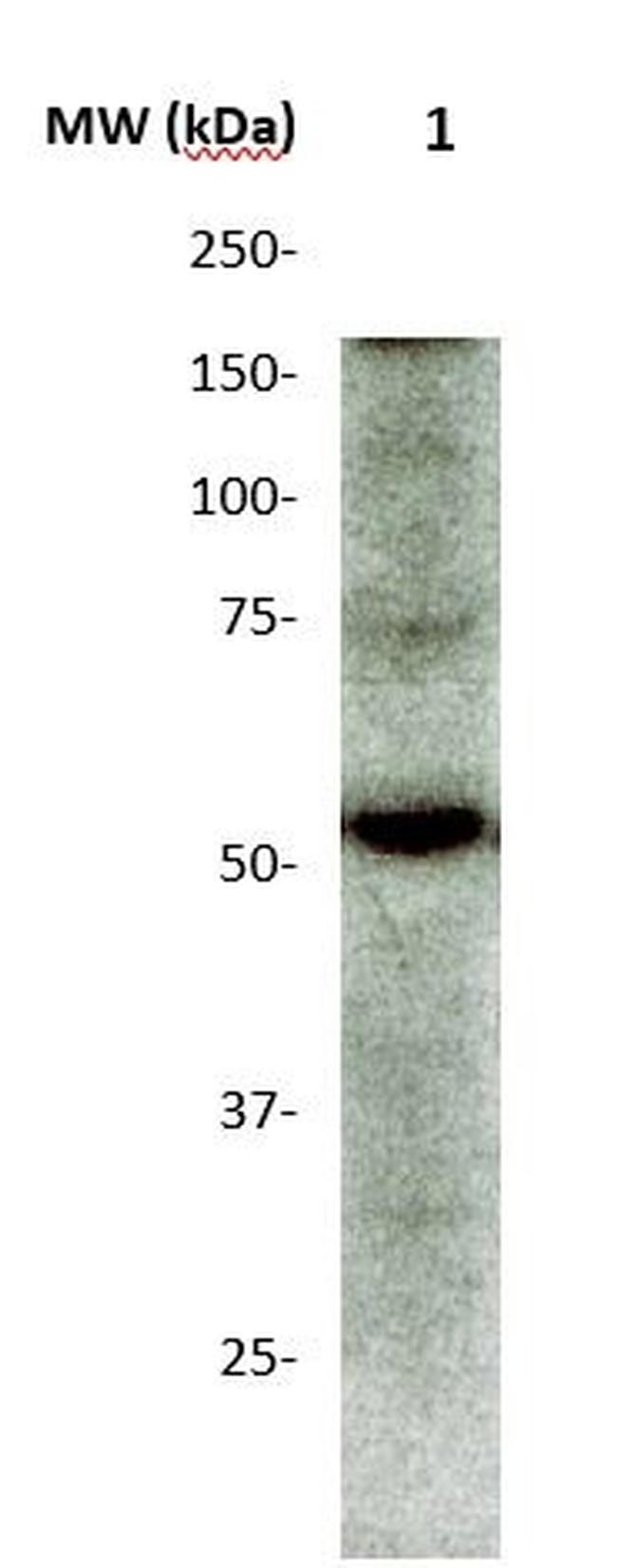 Phospho-CamKII (Thr286) Antibody in Western Blot (WB)