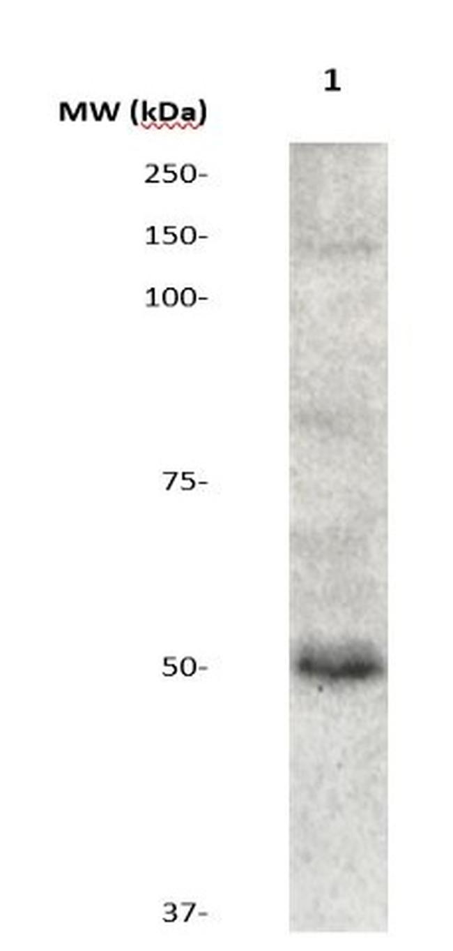 Phospho-GSK3a (Ser21) Antibody in Western Blot (WB)