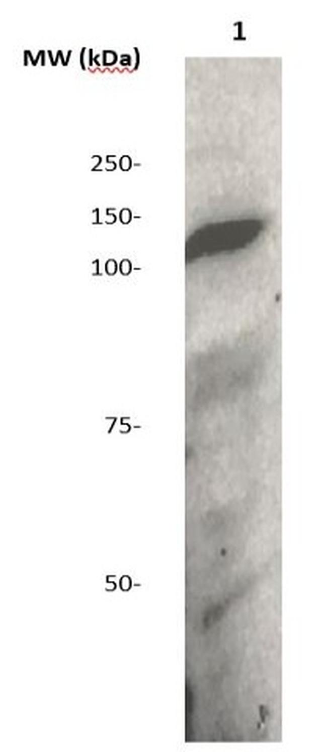 JAK1 Antibody in Western Blot (WB)