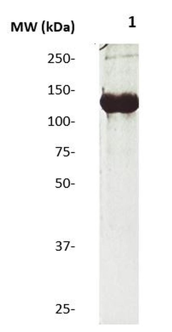 JAK2 Antibody in Western Blot (WB)