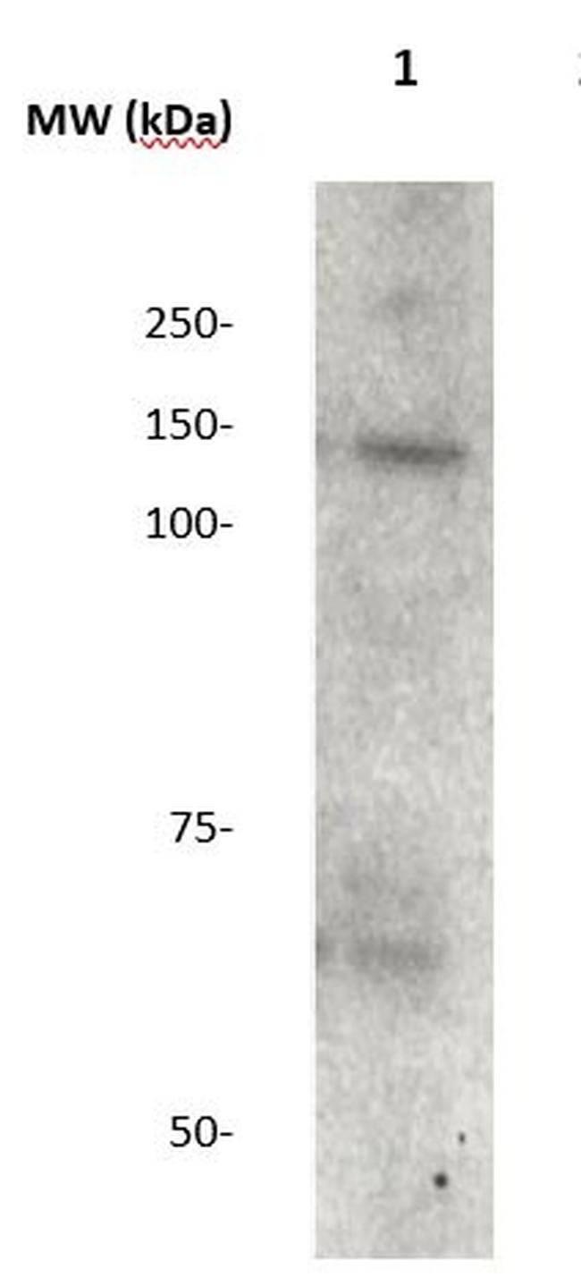 JAK3 Antibody in Western Blot (WB)