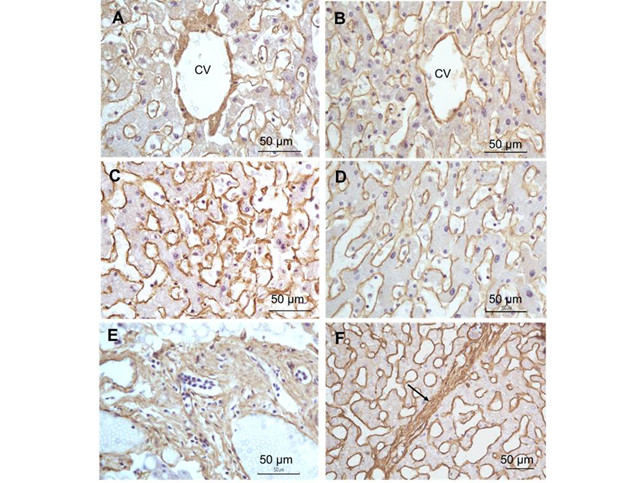 Collagen Type I Antibody in Immunohistochemistry (Paraffin) (IHC (P))