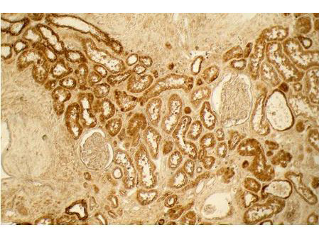 Collagen Type I Antibody in Immunohistochemistry (Paraffin) (IHC (P))