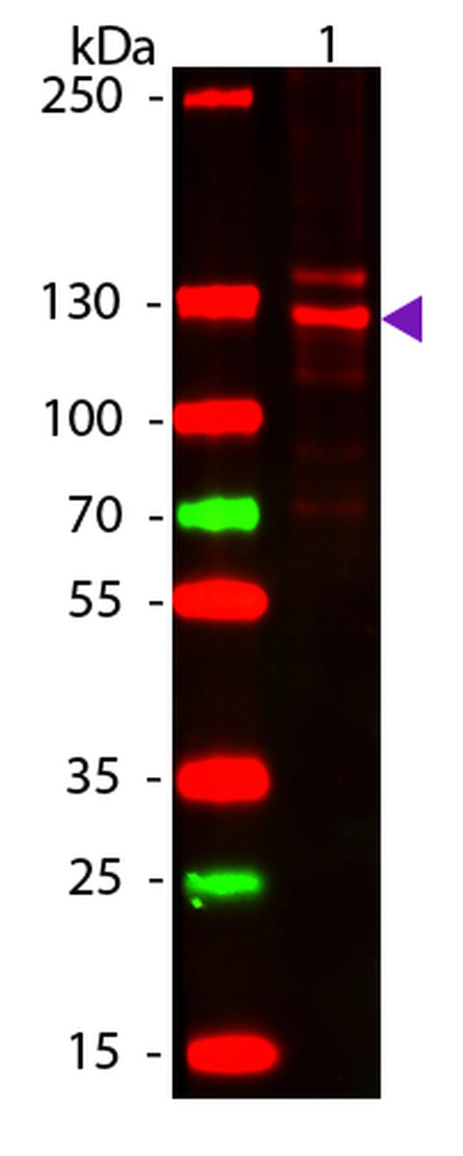 Collagen Type I Antibody in Western Blot (WB)