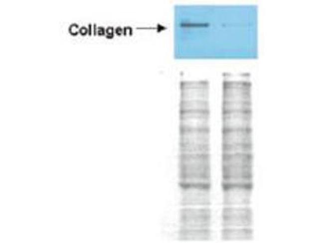 Collagen Type I Antibody in Western Blot (WB)