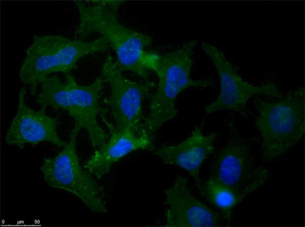 beta Amyloid Antibody in Immunocytochemistry (ICC/IF)