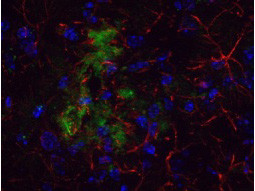 beta Amyloid Antibody in Immunohistochemistry (Frozen) (IHC (F))