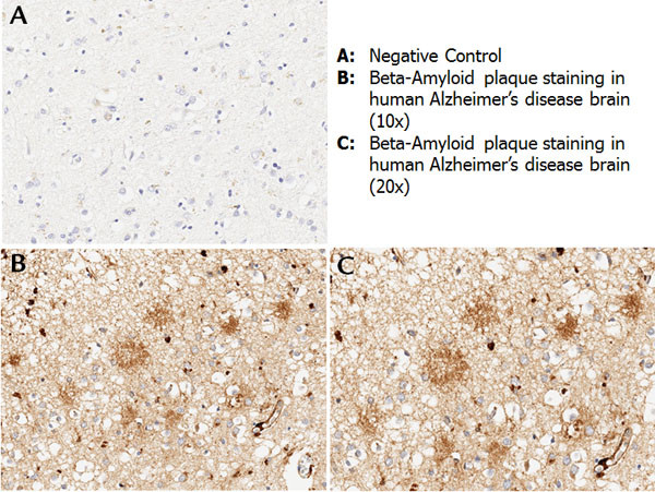 beta Amyloid Antibody in Immunohistochemistry (Paraffin) (IHC (P))