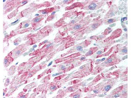 beta Amyloid Antibody in Immunohistochemistry (Paraffin) (IHC (P))