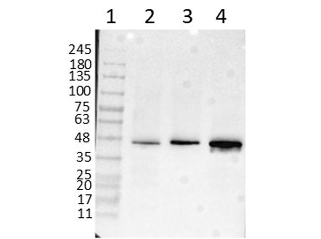 beta Amyloid Antibody in Western Blot (WB)