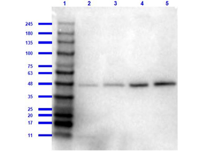 beta Amyloid Antibody in Western Blot (WB)