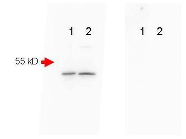 beta Amyloid Antibody in Western Blot (WB)