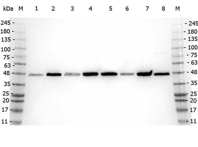 beta Amyloid Antibody in Western Blot (WB)