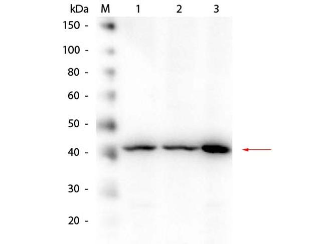 beta Amyloid Antibody in Western Blot (WB)