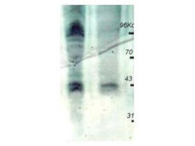 Phosphothreonine Antibody in Western Blot (WB)