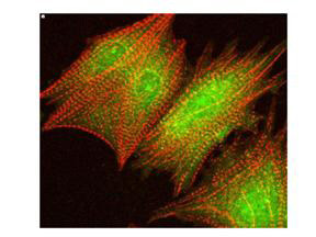 Phospho-AKT (Ser473) Antibody in Immunocytochemistry (ICC/IF)