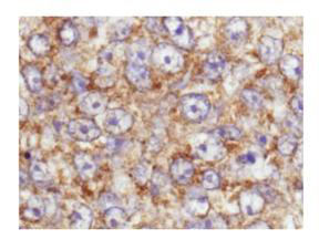 Phospho-AKT (Ser473) Antibody in Immunohistochemistry (Paraffin) (IHC (P))