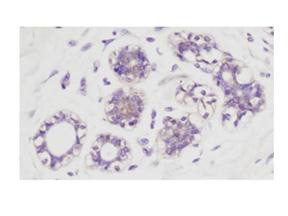 Phospho-AKT (Ser473) Antibody in Immunohistochemistry (Paraffin) (IHC (P))