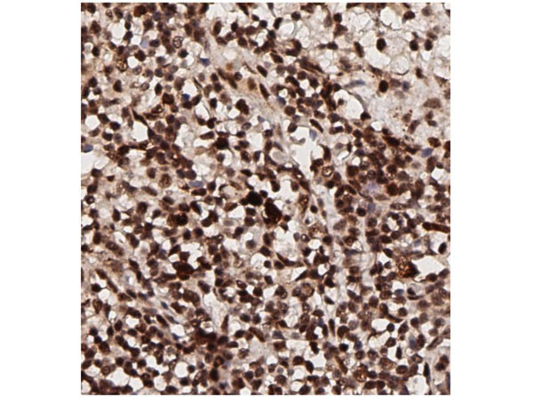 Phospho-AKT (Thr308) Antibody in Immunohistochemistry (IHC)