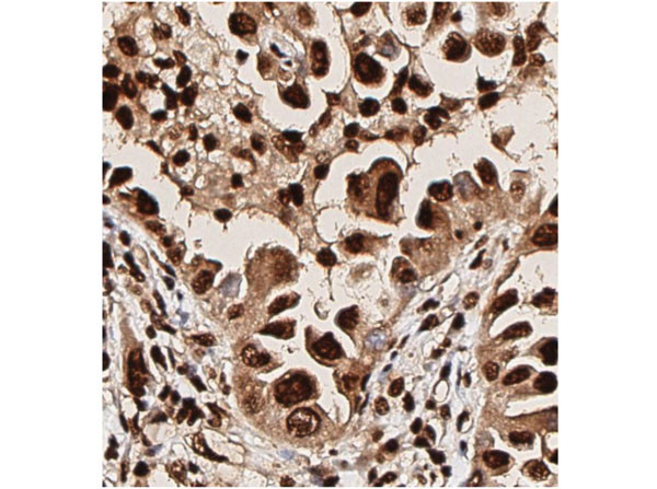 Phospho-AKT (Thr308) Antibody in Immunohistochemistry (IHC)