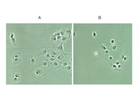 NFkB p65 Antibody in Immunocytochemistry (ICC/IF)