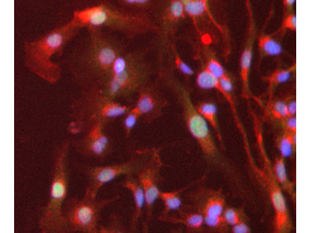 PPAR alpha Antibody in Immunocytochemistry (ICC/IF)