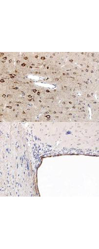 PPAR alpha Antibody in Immunohistochemistry (Paraffin) (IHC (P))