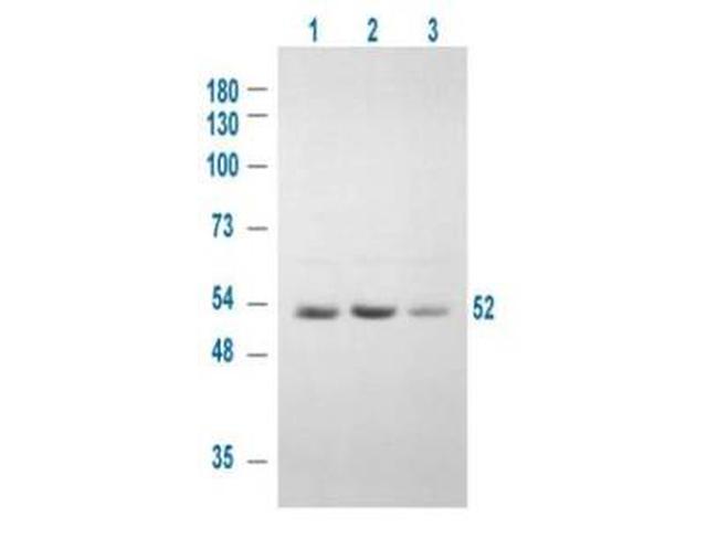 Phospho-GSK3 alpha (Ser21) Antibody in Western Blot (WB)