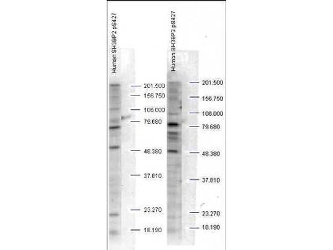 Phospho-SH3BP2 (Ser427) Antibody in Western Blot (WB)