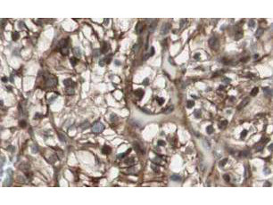 MAD2L2 Antibody in Immunohistochemistry (Paraffin) (IHC (P))