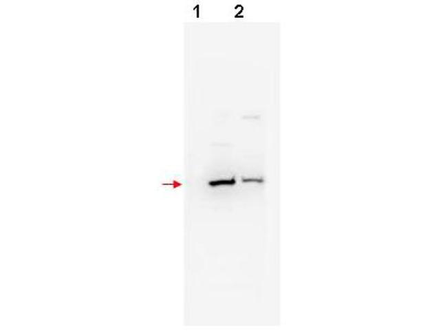 beta TrCP2 Antibody in Western Blot (WB)